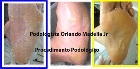 Podologo Orlando Madella Jr